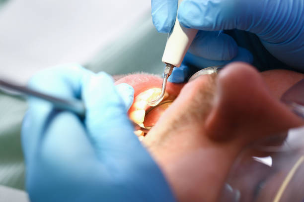 Best Pediatric Emergency Dentist in Mead, CO